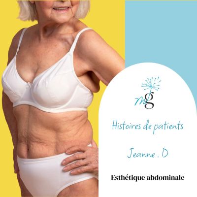 Histoires de patients, esthétique abdominale